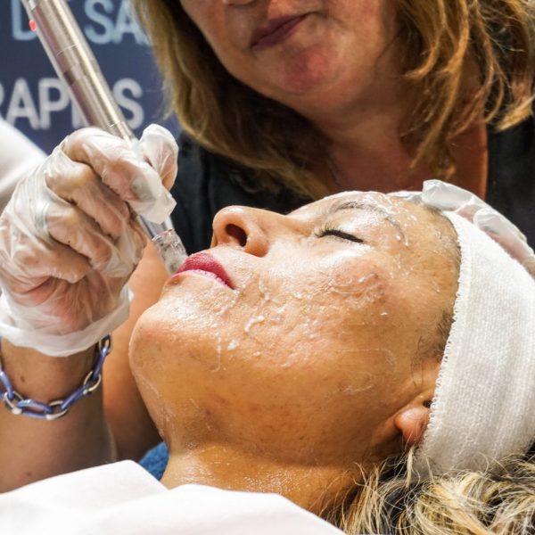 Kapydermia Microneedling Facial and Capilar