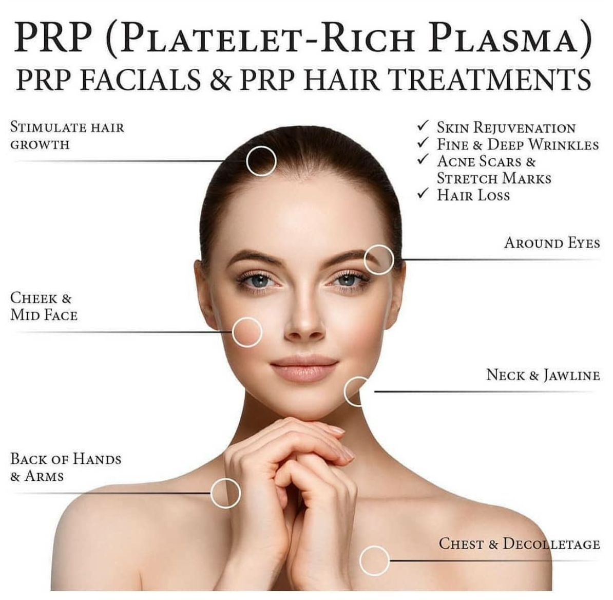 Plasma Rico en Plaquetas (PRP)